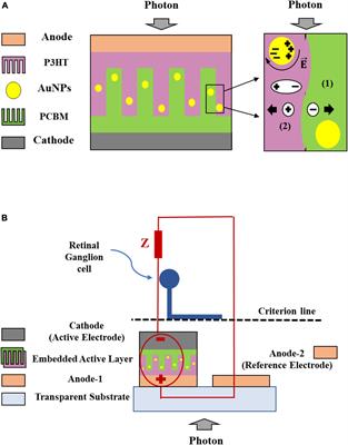 Computational analysis of efficient organic solar cell-based retinal prosthesis using plasmonic gold nanoparticles